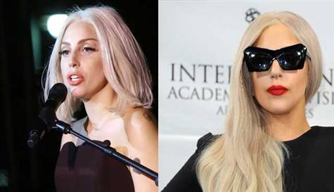 Lady Gaga burun estetiği mi yaptırdı?