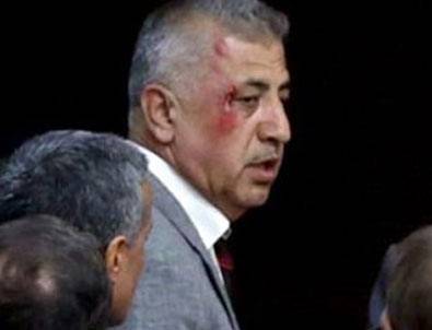 Meclis'te kanlı kavga