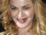 MADONNA - Altın dişli Madonna