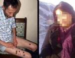 Diyarbakır'da bir kadın kocasının üzerinde sigara söndürdü