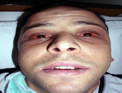 Domuz Etli Çiğ Köfte Davası Yargıya Takıldı