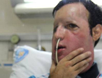 5. yüz naklinin ilk görüntüleri yayınlandı