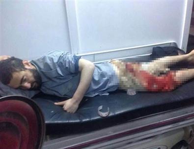 İşid Militanı Sanılan Engelli Vatandaş 5 Yerinden Bıçaklandı