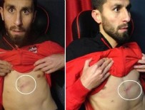 Gökhan Töre'nin Dirseğinden Sonra Şenol Can'dan Olay Fotoğraf!