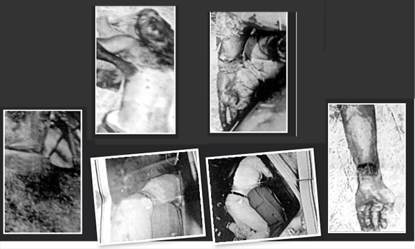 ASELSAN mühendisinin sır ölümünün olay yeri fotoğrafları