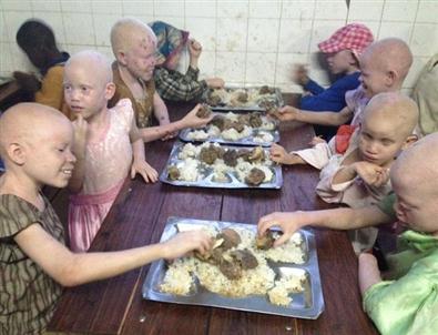 Burhaniye Belediyesi Tanzanya’daki 'Albino Köyü'Ne Destek Olacak