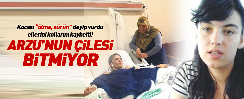 Elini ayağını koca şiddetinde yitirdi