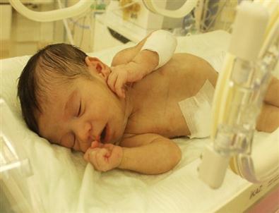 Doğduktan 3 Gün Sonra Ameliyatla Hayata Tutundular