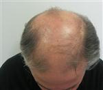 Saç Teli İle Rekor