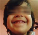 BILKENT - Batman’da Bir Günde 2 Çocuk Yüksekten Düşerek Öldü