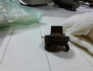 Okmeydanı'nda ölen vatandaşın başından su borusu parçası çıkartıldı