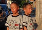 TEPECIK EĞITIM VE ARAŞTıRMA HASTANESI - Balık Pulu Hastalığına Yakalanan İkizler Yardım Bekliyor