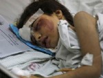 HAVAN SALDIRISI - Gazze'de ölü sayısı 500'ü geçti