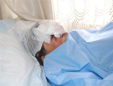 (özel Haber) Kurdun Saldırısına Uğrayan Kadın İha’ya Konuştu