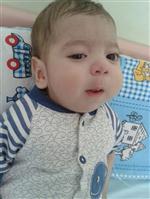 KEMİK HASTALIĞI - Berk Bebek Yaşama Tutunamadı