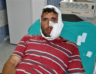 Sivas’ta Kurt Saldırısı 6 Kişiyi Hastanelik Etti