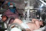 BEYİN DOKUSU - (özel Haber) 'Yaşamaz' Denilen Gülnur Bebek Ameliyatla Hayata Tutundu