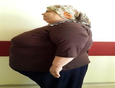 Gazi Yaşargil Hastanesi Obezitede Umut Kapısı Oldu