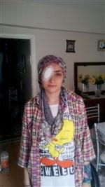 KORNEA NAKLİ - Kornea Nakliyle İşığa Kavuştu