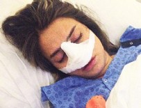 CEYDA ATEŞ - Ceyda Ateş'in burnu kırıldı