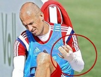 BİLD - Robben'i timsah ısırdı!
