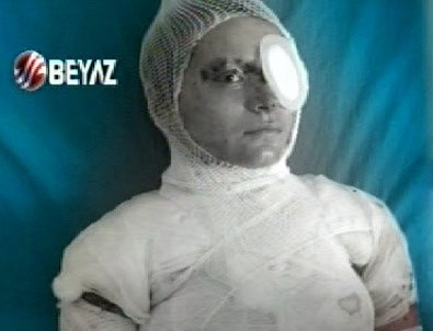 O kadın Beyaz Haber'e konuştu