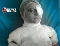 NUMUNE HASTANESİ - O kadın Beyaz Haber'e konuştu