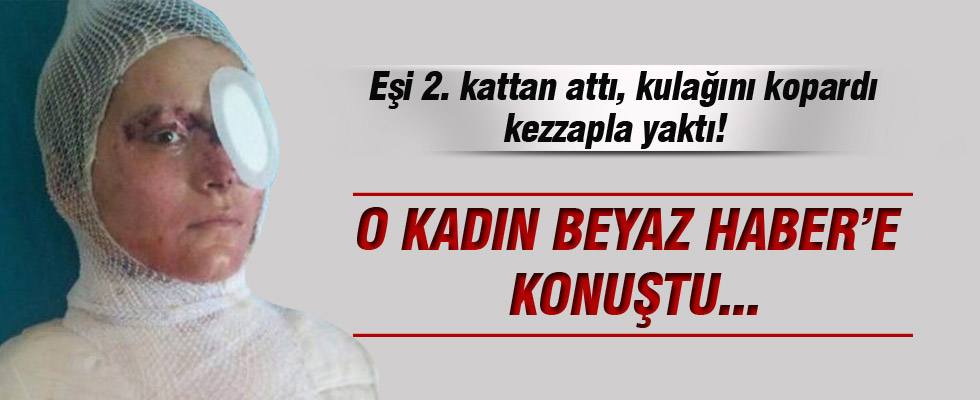 O kadın Beyaz Haber'e konuştu