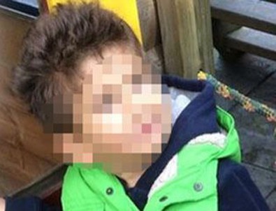 Eniştesinin asitli saldırısına uğrayan çocuk ilk kez görüntülendi