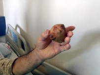 Çaycuma Devlet Hastanesi'nde Başarılı Ameliyatla Sağlığına Kavuştu