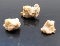 HÜSEYİN ÇELİK - Böbrek taşını önlemenin 10 yolu