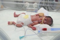 KALP AMELİYATI - 750 Gram Bebeğin Kalbindeki Delik Ameliyatsız Yöntemle Kapatıldı