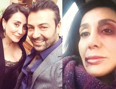 Saruhan Hünel sessizliğini bozdu