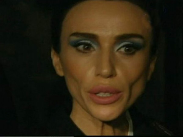 Gülşen'in vücudu alarm veriyor