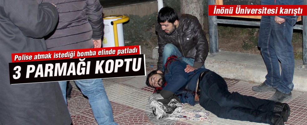 Polise atmak istediği bomba elinde patladı