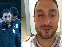 LUKAS PODOLSKI - Podolski, Mert Çetin'in gözünü morarttı!