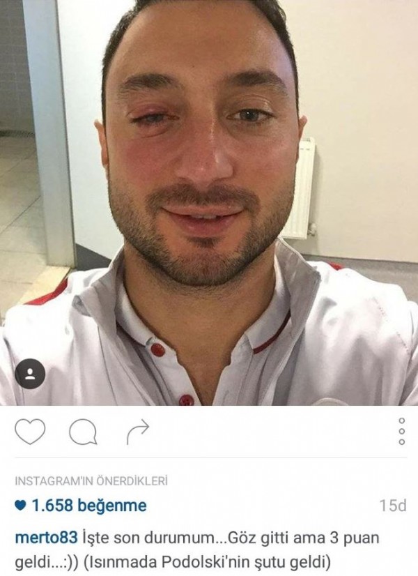Podolski, Mert Çetin'in gözünü morarttı!