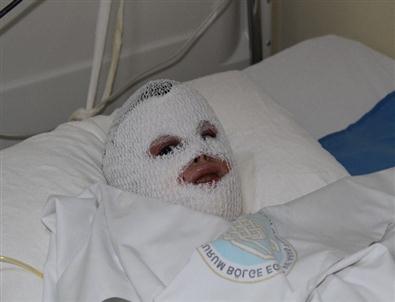 Savaştan Kaçtı, Yangından Kurtulamadı