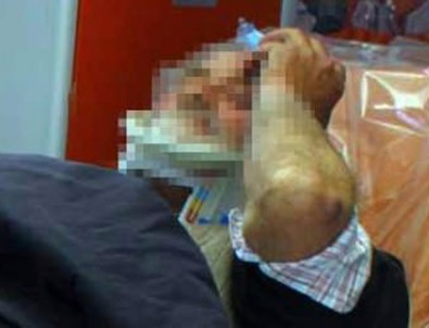 70 yaşındaki adamı dövdüler