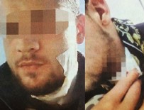 PSİKOLOJİK ŞİDDET - Sevgilisine laf atan adamın boynunu ısırdı