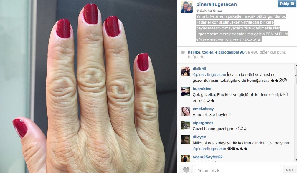 Pınar Altuğ ellerini bir kez daha paylaştı
