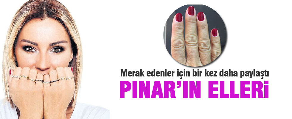 Pınar Altuğ ellerini bir kez daha paylaştı