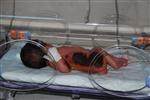 TALİHSİZ BEBEK - Hastanede Doğum Sonrası İsıtıcıda Unutulan Bebekte Yüzde 40 Oranında Yanık Oluştu