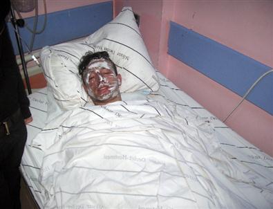 İsınmak İçin Yaktıkları Ateşle Yandılar