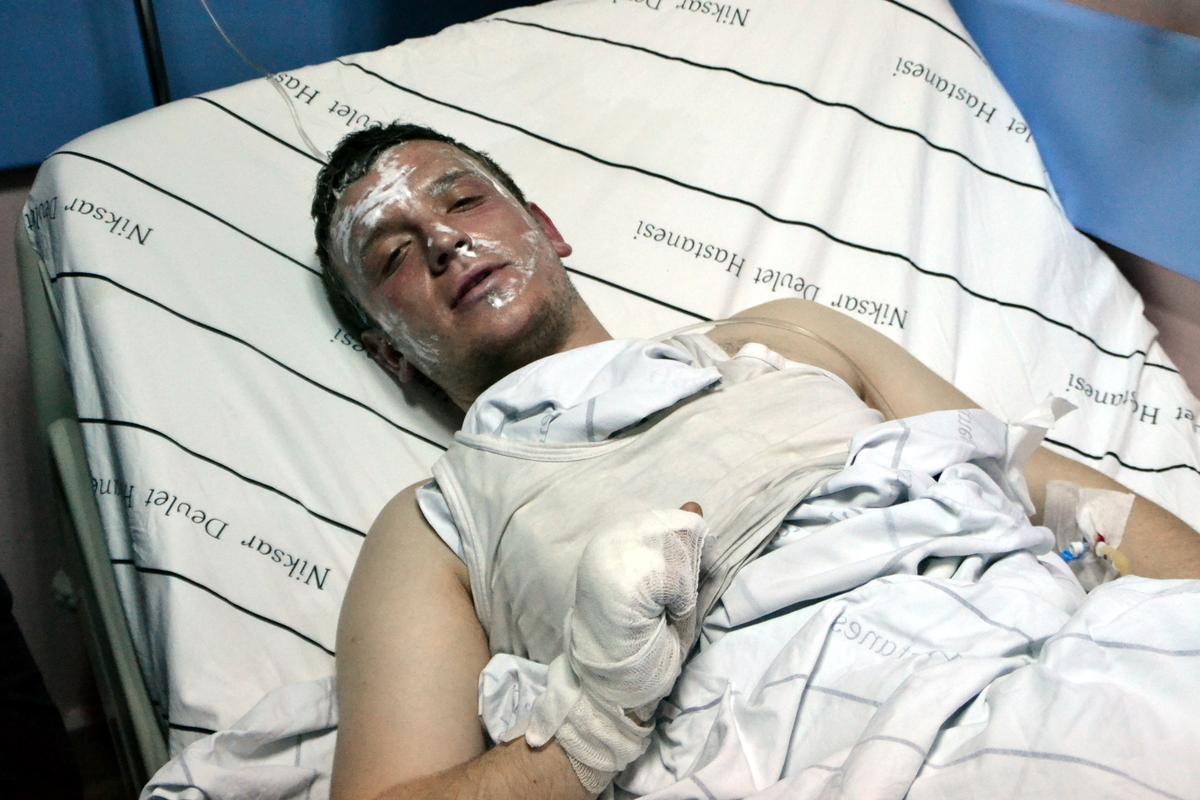 Isınmak için yaktıkları ateşe benzin dökünce yaralandılar