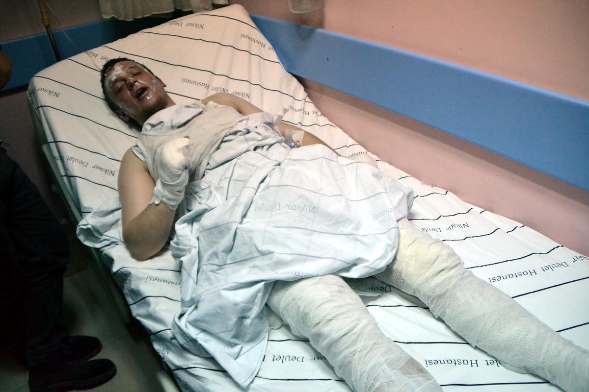 Isınmak için yaktıkları ateşe benzin dökünce yaralandılar