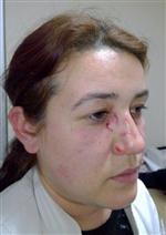 TAŞERON FİRMA - Hastanede Dedikodu Kavgası