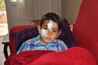 SOKAK KÖPEĞİ - Köpek Çocuğun Yüzünü Isırdı