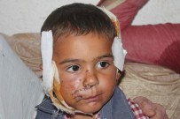 İSMAIL GÜMÜŞ - Başıboş Köpeğin Saldırdığı 2 Yaşındaki Çocuk Yaralandı