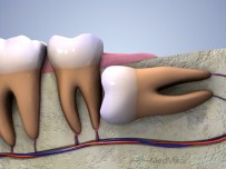 ÇENE KEMİĞİ - 'Dişte Cerrahi Müdahale Son İhtimal Olmalı'